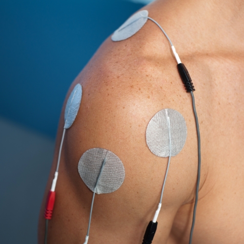 electrical-stimulation-Optimum-Healh-and-Wellness-Ketchikan-AK