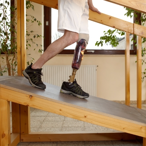 post-amputee-care-Optimum-Healh-and-Wellness-Ketchikan-AK